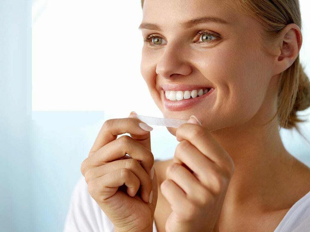 TOP MIẾNG DÁN TRẮNG RĂNG TỐT HIỆU QUẢ NHẤT HIỆN NAY 2 mieng dan trang rang la gi uu nhuoc diem ma ban can biet 1